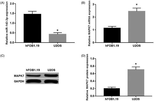 Figure 1. Expression of MAPK7 and miR-143-3p in U2OS cells. (A) The expression of miR-143-3p mRNA in U2OS and hFOB1.19 cells; (B) the expression of MAPK7 mRNA in U2OS and hFOB1.19 cells; (C) the detection of MAPK7 protein expression; (D) the MAPK7 protein in U2OS and expression levels in hFOB 1.19 cells. Compared with hFOB1.19 cells, *p < .05.