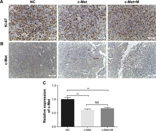 Figure 8 Immunohistochemistry assay.Notes: (A) Histological examination of Ki-67. Ki-67-based qualification of cell proliferation in the tumor tissues (magnification ×400). (B) c-Met immunohistochemistry assay. IHC analysis of c-Met protein expression level in orthotopic tumors (magnification ×200). (C) The c-Met mRNA expression of tumor. Quantitative PCR of the tumor was used to assess the inhibition of tumor growth. **P<0.01.Abbreviations: IHC, immunohistochemistry; M, magnet; NC, negative control; NS, non-significance; PCR, polymerase chain reaction.