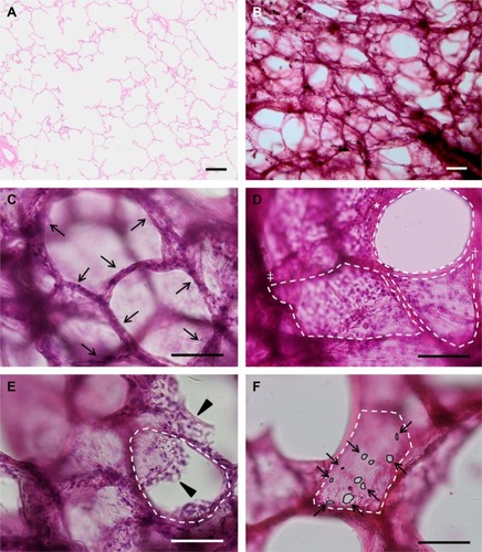 Figure 1 Images (H&E) of the lung showing 4 μm thick (A) and 300 μm thick (B–F) sections at ×40 magnification (A and B) and ×100 magnification (C–F).