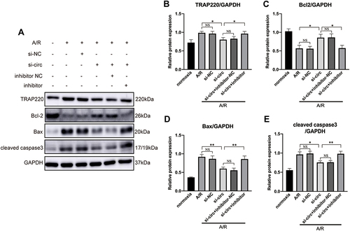 Figure 5 Representative Western blots (A) and quantitative analysis (B–E) of TRAP220 (MED1), Bcl2, Bax and cleaved caspase 3, showing that inhibition of miR-146a reversed the effect of circRNA Fbxl5 knockdown on the expression of MED1 and cardiomyocyte apoptosis; *P<0.05 and **P<0.01; NS=non-significance.