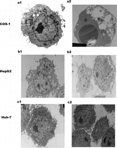 Figure 3 Electron microscopy (EM) of SARS N transfected three cell lines. a1: Mock transfected COS-1 cell with a normal nucleus, well-preserved cytoplasm, containing well-preserved mitochondria. a2: SARS coronavirus N transfected COS-1 cell shows large dark mass of electron dense material in the nucleus, which clumped into a uniform sphere with a degenerated cytoplasm, comparable to that of mock transfected cells. b1: mock transfected HepG2. b2: N transfected HepG2.c1: mock transfected Huh-7 .c2:N transfected Huh-7. There is no obvious change in N transfected cells HepG2 and Huh-7 cells. Magnification: a1, b1, b2, c1,c2 (5000 ×), a2 (6700 ×).