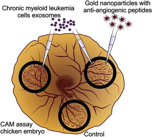 Figure 1 Antiangiogenic gold nanoparticles block the chronic myeloid leukemia (K562) derived exosomes induced angiogenesis.