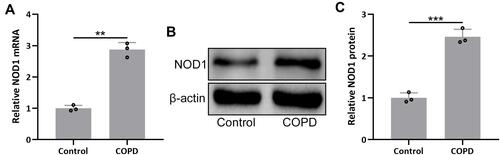 Figure 1 NOD1 was up-regulated in the lungs of mice exposed to cigarette smoke (CS). RT-qPCR and Western blotting were used to analyze the mRNA (A) and proteins expressions (B and C) of NOD1 in the lung tissues between the controls and CS exposed mice. Data shown are mean ± SD. n = 3 for each group. **p < 0.01 and ***p < 0.001 between the indicated groups. Unpaired t-test.