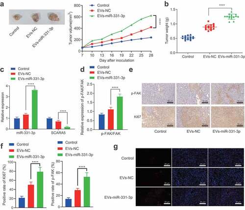 Figure 7. CAFs-derived EVs transport miR-331-3p to promote the tumorigenesis of PC in vivo.