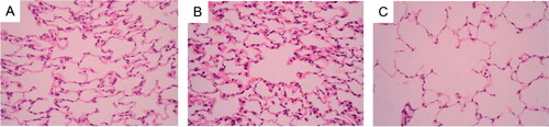 Figure 1. Histology of lung tissue. Notes: Lung tissue section was stained with HE. (A) Control rats receiving normal CD4 + T cells, adjuvant and PBS; (B) Rats receiving adjuvant and PBS; (C) Rats receiving CD4 + T cells hypomethylated, adjuvant and PBS. Data presented were one representative image data. Magnification: 400×. Abbreviations: HE, hematoxylin-eosin; PBS, phosphate buffered saline.