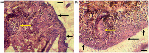 Figure 8. Optical light photomicrographs of histological sections of excised sheep nasal mucosa (scale bar: 10 μm, magnification: 400×), (a) untreated control nasal mucosa, (b) nasal mucosa treated with ROPI-DS nanoplex (1.5:1) (sample treatment includes application of 100 μL suspension of ROPI-DS nanoplex formulations for 2 h; Black arrow indicates mucus layer and yellow arrow indicates goblet cells).