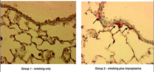 Figure 2 There is greater neutrophil degranulation (immunoperoxidase stain, arrows) in the outer wall of a small airway (diameter ≤ 200 μm) for a smoking plus Mp mouse (group 2) compared to a smoking without Mp mouse (group 1).