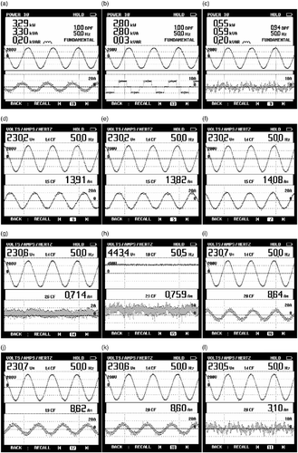 Figure 5 Steady-state performance of the VFC at wind speed (11.53 m/s) and balanced nonlinear loads: (a) v AB and P s; (b) v AB and P L; (c) v AB and P b; (d) v AB and i gA; (e) v AB and i gB; (f) v AB and i gC; (g) v AB and i b; (h) v bb and i b; (i) v AB and i sA; (j) v AB and i sB; (k) v AB and i sC; (l) v AB and i vscC.