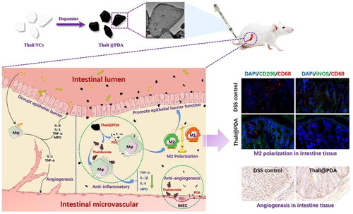 Figure 9. A schematic diagram figure showing the tissue damage and angiogenesis status in IBD lesions before and after treatment with Thali@PDA. The specific therapeutic mechanisms of Thali@PDA have also been depicted (Meng et al., Citation2023). Copyright 2023, Elsevier Ltd.