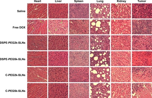 Figure 10 Histology of H & E stained organs and tumor from MCF-7/MDR xenograft-bearing Balb/c nude mice subjected to varying therapeutic treatments.Abbreviations: H & E, hematoxylin and eosin; MDR, multidrug resistance; DSPE-PEG2k/5k-SLNs, 1,2 distearoyl-sn-glycero-3-phosphoethanolamine-N-[methoxy(polyethylene glycol)]2000/5000-solid lipid nanoparticles; C-PEG2k/5k-SLNs, cholesterol-poly(ethylene glycol)2000/5000-solid lipid nanoparticles; DOX, doxorubicin.