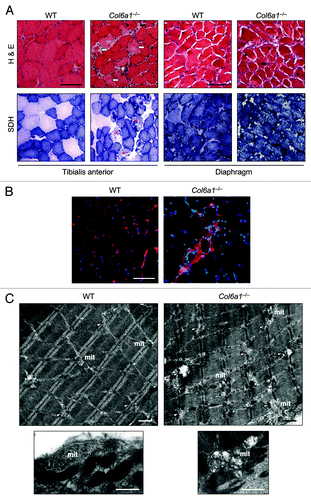 Figure 3. Treadmill exercise causes muscle wasting in Col6a1–/– mice. (A) Representative cross-sections of TA and diaphragm muscles stained with H & E or with histochemical reaction for SDH and isolated from 5-mo-old wild-type and Col6a1–/– mice after 1 h treadmill exercise. H & E staining shows normal morphology in both muscles of wild-type animals after treadmill. Instead, TA from Col6a1–/– mice after treadmill displays severe muscle degeneration characterized by inflammation (white asterisk), degenerating myofibers (white arrows), centrally nucleated fibers (black arrowheads), and atrophic myofibers (black arrows). The extent of muscle degeneration in the diaphragm of Col6a1–/– mice after treadmill is similar to that observed in standard conditions. SDH staining of TA and diaphragm is normal in wild-type mice after treadmill. In Col6a1–/– animals subjected to treadmill several abnormal poorly stained fibers (red asterisks) are present in TA, while the diaphragm displays an apparently normal SDH staining. Scale bar, 100 μm. (B) Representative IgG immunolabeling images of TA cross-sections from wild-type and Col6a1–/– mice after 1 h of treadmill exercise, confirming extensive inflammation in Col6a1–/– TA but not in the corresponding wild-type samples. Scale bar, 100 μm. (C) Electron micrographs of TA from wild-type and Col6a1–/– mice after treadmill exercise. Col6a1–/– TA displays a large number of severe ultrastructural alterations, while wild-type TA presents fibers with dilated sarcoplasmic reticulum and some altered mitochondria. Col6a1–/– TA displays a marked accumulation of dilated sarcoplasmic reticulum (arrowheads) and abnormal mitochondria. Almost all Col6a1–/– mitochondria appear fragmented and many of them with completely swollen cristae, while the majority of wild-type mitochondria maintain elongated shape and normal cristae morphology (lower panels). Scale bars, 1 μm. mit, mitochondria; WT, wild-type.