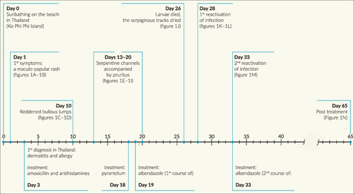 Figure 4 Timeline illustrating the chronology of the disease’s progression in the man.