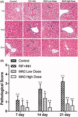 Figure 2. Histopathology changes of control, RIF + INH, MAG low-dose, and MAG high-dose groups after treated for 7, 14, and 21 d. (A) Photomicrography of liver sections; (B) statistical analysis of HAI (histological activity index) scores. ① acidophilic and pyknosis ② inflammation and necrosis ③ fatty degeneration. Images of all groups were taken at ×200 magnification. Data are shown as mean ± SD. Each group at each time point contained five rats. Δp < 0.05 versus the control group; ΔΔp < 0.01 versus the control group; *p < 0.05 versus the RIF + INH group; **p < 0.01 versus the RIF + INH group.