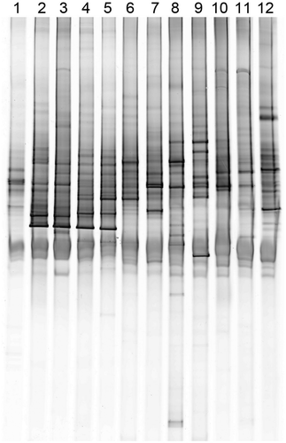 Figure 2. The DGGE profile of 18S rRNA gene fragments amplified from the natural plankton community in the Houxi River. Lanes 1–12 denote sampling sites 1–12, respectively.