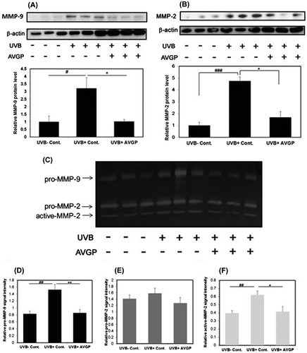 Fig. 6. Expression and gelatinolytic activity of MMP-9 and MMP-2 after 6 weeks of UVB irradiation.