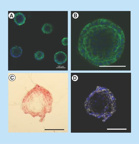 Figure 3.  Presence of a lumen-like cavity in the center of cryosectioned MCF-12A acini.Confocal microscopy images of acini immunolabeled with an E-cadherin (adherens junctions)-specific antibody (green). Nuclei are stained with 4′,6-diamidino-2-phenylindole (blue). (C) Optical microscopy image of acini cryosection stained with Masson's trichrome staining. (D) Confocal microscopy image of an acini cryosection immunolabeled with a β-catenin (adherens junctions)-specific antibody (white). Nuclei are stained with 4′,6-diamidino-2-phenylindole. Scalebars: 100 μm.