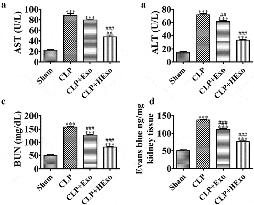 Figure 2. Effects of ADSC exosomes on organ dysfunction and vascular leakage in CLP-induced sepsis. (a-c) Plasma levels of AST (a), ALT (b) and BUN (c), 24 hr after CLP. **p < 0.01, ***p < 0.001 vs sham. ##p < 0.01, ###p < 0.001 vs CLP-PBS. (d) Vascular leakage in the kidney, measured via injection of Evans blue dye at 24 hr after CLP. ***p < 0.001 vs sham. ###p < 0.001 vs CLP-PBS.