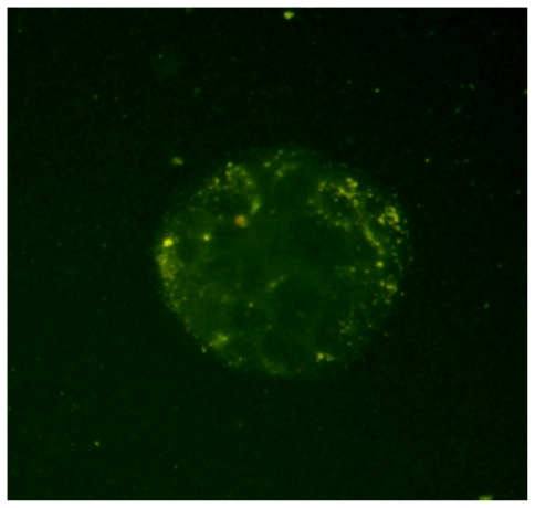 Figure 5 Fluorescence microscopic images of Caco-2 cells after 2 hours incubation with fluoresceinamine (FA)-loaded nanoparticles at 37°C. As shown in the image, the yellow fluorescence of the FA-loaded nanoparticles is distributed in the cytoplasm, indicating the uptake of nanoparticles by the cells.