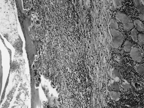 Figure 8.  Magnified view of Figure 1. Inflammation of temporal bone (left) and surrounding muscle (right). Haematoxylin and eosin. Bar = 50 µm.