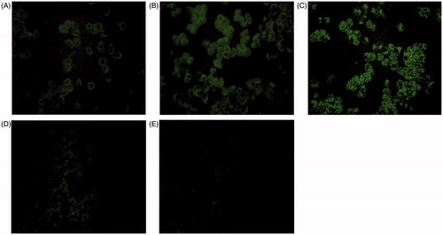 Figure 2. Fluorescence images of MCF-7 cells after incubation with FITC-labeled PTX-loaded CS-TOS micelles for (A) 2 h, (B) 4 h, (C) 8 h, (D) 24 h, and (E) FITC-labeled CS for 8 h.