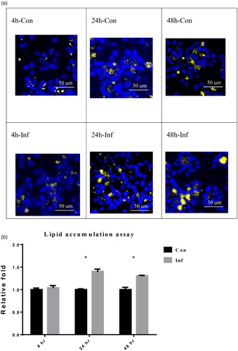 Figure 1. Lipid accumulation in LMH-2A cells evaluated using a fluorescent stain at 4, 24, and 48 hpi with SE. (a) The lipid contents were observed under a fluorescence microscope at 4, 24, and 48 hpi. The blue areas indicate cell nucleus staining (Hoechst 33342 stain) and the yellow areas indicate cellular lipid droplet staining (Nile Red stain). (b) Semi-quantitative comparisons of lipid accumulation from Figure 1(a) between groups of SE-infected (Inf) LMH-2A cells and control (Con) LMH-2A cells co-incubated with β-oestradiol. Error bars indicate the SEM values. Asterisks represent significant differences (P < 0.05) between Inf and Con groups at the same time point.