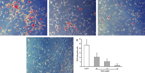 Figure 3. (×150): Three days after drug delivery. The control group showed plenty of TRAP staining-positive osteoclasts. Compared with the control group, the RANK groups decreased significantly. A: the control group; B: 10−6 mol/L group; C: 10−5 mol/L group; D: 10−4 mol/L group; E: for the TRAP staining-positive cells counting (n = 10), the number of TRAP-positive cells in the RANK groups significantly reduced compared with the control group, which was in a dose-dependent manner (×100) and was statistically significant (P <0.01).