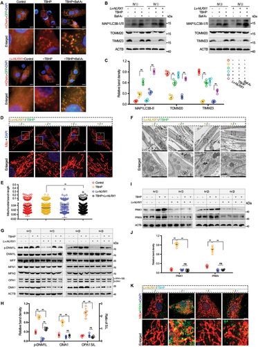 Figure 4. NLRX1 induces selective mitochondrial fission and mitophagy to maintain adaptive mitochondrial morphology. Primary human NP cells isolated from degenerated NP tissues were prepared. (A) Co-localization analysis of mCherry and GFP in live stable mCherry-GFP-MAP1LC3B-expressing NP cells following the treatments of PBS, TBHP or Baf-A1 with NLRX1 overexpression or not, scale bar: 200 μm. (B and C) protein expressions of mitophagy indicators (MAP1LC3B-II, TOMM20, TIMM23) in primary human NP cells isolated from degenerated NP tissues following the treatments of PBS, TBHP or Baf-A1 with NLRX1 overexpression or not, as determined by western blotting. (D-F) mitochondrial morphology analysis by fluorescence microscope with MitoTracker Red CMXRos label (D and E) and transmission electron microscopy (TEM) (F) in primary human NP cells isolated from degenerated NP tissues following the treatments of PBS or TBHP with NLRX1 overexpression or not, fluorescent scale bar: 5 μm, TEM scale bar: 2 μm (upper panel), 500 nm (lower panel). (G and H) protein expressions of mitochondrial dynamics indicators (p-DNM1L, DNM1L, MFF, MFN1, MFN2, OPA1, OMA1) in primary human NP cells isolated from degenerated NP tissues following the treatments of PBS or TBHP with NLRX1 overexpression or not. (I and J) protein expressions of PINK1 and PRKN in primary human NP cells isolated from degenerated NP tissues following the treatments of PBS or TBHP with NLRX1 overexpression or not. (K) confocal analysis of MitoTracker labeling and PRKN protein with if staining in primary human NP cells isolated from degenerated NP tissues following the treatments of PBS or TBHP with NLRX1 overexpression or not, scale bar: 10 μm. Data are represented as mean ± SD. *p < 0.05, **p < 0.01.