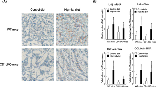 Figure 2 Liver histology by oil red O staining and the mRNA expression levels of inflammation and fibrosis markers in the liver after 16 weeks of CTD or HFD feeding. Mice were fed a CTD or HFD for 16 weeks. Liver tissue was stained with oil red O. Observation was performed under at 200-fold magnification (A). Representative images of each liver sections are shown. The mRNA expression level of each marker was determined by quantitative real-time PCR. Five to six mice were used per group (B).