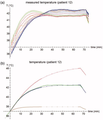 Figure 2. (a) Temperature measurements of patient #12. Each point represents an individual measurement, the lines are moving five-point averages as a guide to the eye. Sensors 1–2 (pressed against the bladder wall) are shown in orange, sensors 3–8 (in the bladder lumen) in blue, sensors 9–10 (fixation balloon) in purple, sensors 11–12 (urethra, near the bladder) in red, and sensors 13–14 (urethra, further from the bladder) in green. While the tip of the probe is inside the bladder, the last few sensors are in the urethra, leading to a different temperature profile. For the first 15 min, the temperature increases roughly linearly; after about 40 min, steady state temperatures are reached. (b) Temperature measurement for sensor #7 (patient #12) at 3 cm from the probe tip (green), and the temperature simulations by the muscle-like model (brown stars), the static model (red empty squares), and the dynamic model (blue filled squares). The time axis for the measurements has been shifted so that T = 37 °C at t = 0 s.