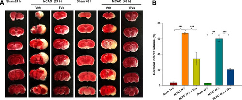 Figure 3 Effects of MSCs-EVs on MCAO-induced cerebral infarction. (A) TTC-stained coronal sections from representative rats from each group at 24 h and 48 h. (B) Quantitative analysis of the cerebral infarct volume. The data are expressed as the mean ± SD (n = 5). ***p < 0.001 by ANOVA with Bonferroni test for post hoc comparisons.