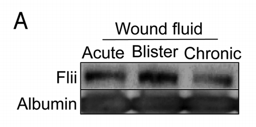 Figure 3. Flii is present in wound fluid from acute and chronic wounds. The clinical investigations were conducted under approval from the Women’s and Children’s Health Network Human Research Ethics Committee, Adelaide, Australia, in accordance to the Declaration of Helsinski principles and with written informed consent. (A) Wound fluid collected from patients undergoing abdominoplasty, from blister fluid and from patients with venous leg ulcers was immunoblotted for Flii and albumin. Flii is secreted into both acute and chronic wounds.