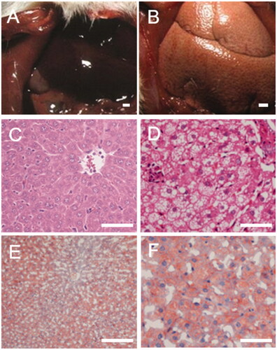 Figure 2. Morphological and pathological detection of liver tissue in rats (A: normal control (NC); B: model control (MC); C: haematoxylin and eosin (H&E) staining of NC; D: H&E staining of MC; E: oil red staining of NC; F: oil red staining of MC).