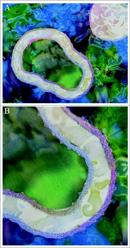 Figure 5. An intermediate stage showing (A) assembly of the autophagic components, and (B) a higher magnification demonstrating the couched stitch surrounding the membranes.