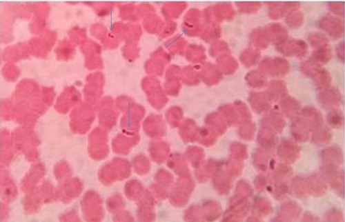 Figure 1. Blood smear showing stages of B. caballi.
