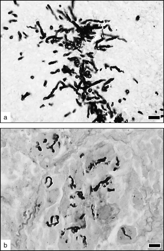 Figure 4.  Morphological evolution of fungi. (4a) Numerous, well-stained and well-delineated conidia and hyphae in an acute exudative lesion, 2 days p.i. MS. Bar = 1 µm. (4b) Intra-granulomatous fungi, phagocytized by multinucleate giant cells, 7 days p.i. Hyphae are badly delineated and fragmented, attesting their destruction by the inflammatory cells. MS. Bar = 10 µm.