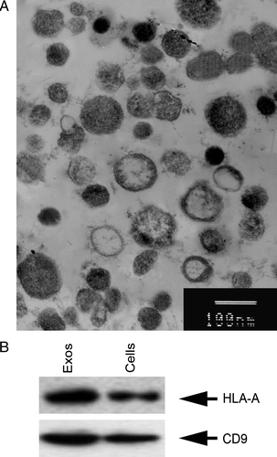 Figure 1.  Identification of tumor-derived exosomes. The exosomes were isolated and purified from SGC7901 cells, and visualized under electron microscopy (A). They had saucer-like vesicles limited by a bilayer membrane, with a size of 30–100 nm. Bars, 100 nm. (B) Western blotting analysis of protein composition of exosomes. Equal amounts of exosome protein derived from SGC7901 cells and lysates were immunoblotted with anti-human HLA-A and CD9 antibodies.