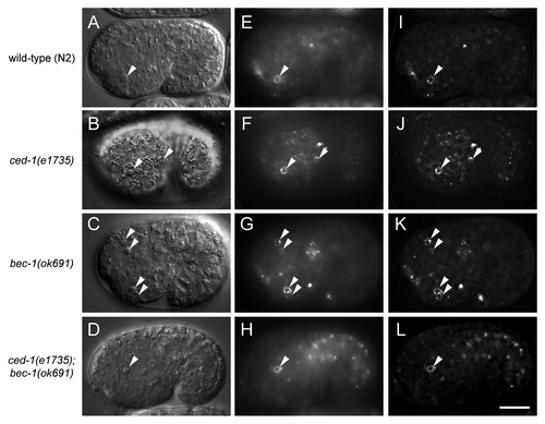 Figure 4. Lack of requirement for bec-1 in the exposure of phosphatidylserine in C. elegans corpses. Representative DIC images (A–D), the corresponding epifluorescence images (E–H), and the corresponding deconvolution images (I–L) showing cell corpses labeled with GFP::Annexin V in vivo in the indicated C. elegans genotype. GFP::Annexin V expression was driven by the dyn-1 promoter as an integrated transgene. Arrows denote corpses labeled with GFP::Annexin V rings. Scale bar: 10 μm.