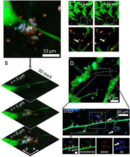 Figure 2. Neurite dystrophy and early amyloid β plaque formation at the sites of retracted neurites caused by anatase TiO2 nanotubes. (A) a maximum intensity projection image of the confocal planes in (B) Composite confocal fluorescence image of an Aβ containing plaque at three different z heights from the signal of probes for neuronal cytosol (green), TiO2 nanotubes (red), Aβ (blue), and Tau (white); (C) live cell imaging of neurite collapse occurring within minutes after nanoparticle exposure, arrow points to a neurite that collapses in contact with the nanotubes; (D) neuronal plasma membrane labeled with CellMask™ deep red (CMDR) (green), high spatial resolution fluorescence image (stimulated emission depletion STED) of synapse damage and early plaque formation (white arrows) at the sites of damaged synapses (green, MEMBRANE) by the nanotubes (red, NANO) containing Aβ (blue, Aβ).