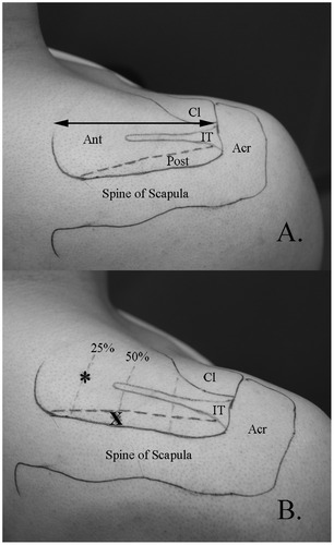 Figure 1. A. External and internal landmarks for electrode placement.