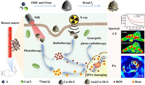 Scheme 1 Schematic illustration of the mechanism of Au@Cu-Sb-S nanoparticles (NPs) in the diagnosis and treatment of breast cancer.