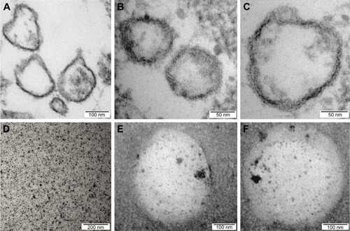 Figure 4 TEM analysis of EVs isolated from hBM-MSCs.Notes: The heterogeneous population of EVs seems to be enriched for exosomes and microvesicles in terms of their size and shape (A–C); the sample of superparamagnetic iron oxide nanoparticles (D); and EVs isolated from hBM-MSCs previously tagged with Molday ION show iron particles localized inside (E and F).Abbreviations: EVs, extracellular vesicles; hBM-MSCs, human bone marrow mesenchymal stem cells; TEM, transmission electron microscopy.