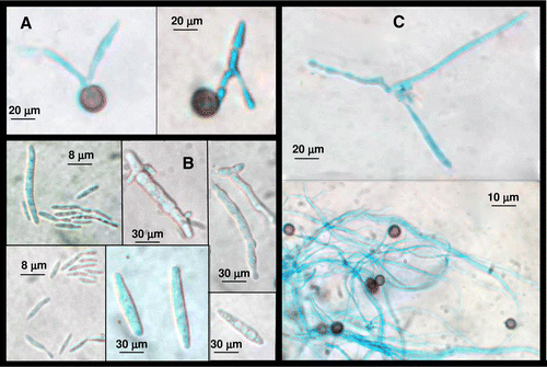 Figure 1.  The sequence of nuclear events in S. scitamineum life cycle stained with 0.1% cotton blue in lactophenol. Cultured for 48 h at 25°C on sterile distilled water. In (A) GT; in (B) HS and in (C) DM.
