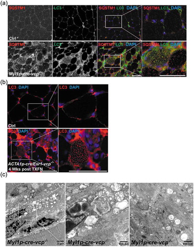 Figure 4. Muscle-specific inactivation of VCP leads to the accumulation of autophagic debris. (a) Co-immunofluorescence for LC3 (green) and SQSTM1 (red), in 6-week-old control or Myl1p-cre-vcp-/- mice. Merged images also contain DAPI nuclei staining (blue). Scale: 100 μm. (b) Immunofluorescence for LC3 (red) and DAPI-stained nuclei (blue) in ACTA1p-cre/Esr1-vcp-/- mice after 4 wk post tamoxifen injection for 5 d. Scale: 100 μm. (c) Electron micrograph images of the TA from Myl1p-cre-vcp-/- mice. Scale bars: 2 μm and 600 nm.