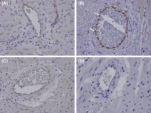 Figure 3. Representative immunohistochemistry for eNOS of a remote intramyocardial artery of a normal heart (A), a graft with ischemia-reperfusion injury only (IRI; B), a graft with ischemia-reperfusion injury and myocardial infarction (IRI + MI; C), and a graft with ischemia-reperfusion injury and myocardial infarction treated with Sildenafil (IRI + MI + S; D) 2 days after reperfusion simulating resuscitation. X40. Note intensive positive endothelial staining (arrows) in a remote intramyocardial artery of a graft with ischemia-reperfusion injury only (IRI; B) as compared with grafts with infarction without (IRI + MI; C) or with Sildenafil (IRI + MI + S; D).