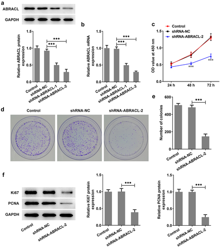 Figure 2. ABRACL knockdown inhibits the level of proliferation in breast cancer cells. (a-b) ABRACL protein and mRNA expression in MCF-7 cells after ABRACL knockdown was examined with the use of western blot and RT-qPCR. ***P < 0.001. (c) The proliferation of MCF-7 cells after ABRACL knockdown was assessed by CCK-8. ***P < 0.001 vs. shRNA-NC. (d-e) The proliferation of MCF-7 cells after ABRACL knockdown was tested by the way of colony formation assay. (f) The expression of Ki67 and PCNA was detected with the adoption of western blot. ***P < 0.001.