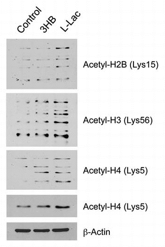 Figure 11 Lactate and ketones increase histone acetylation in MCF7 cancer cells. MCF7 cells were treated with ketones and lactate. Then, we used acetylation-specific antibody probes to assess that status of histone acetylation. Note that both ketones and lactate increased histone acetylation. However, lactate had a more positive effect than ketones, and both resulted in a “laddering” effect, which most likely represents hyper-acetylation plus other protein modifications, such as phosphorylation, which affects the mobility of proteins in SDS-PAGE gels. As such, the lactate- and ketone-induced increases in histone acetylation may contribute to changes in genome-wide transcriptional profiling. For histone H4, two parts are shown. One part shows the higher molecular weight “laddering” species; the other part shows a single band, which most likely represents the mono-acetylated species of histone H4. 3HB, 3-hydroxy-butryate; L-Lac, L-Lactate.
