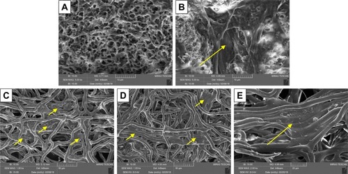 Figure 13 SEM micrographs of the coated fibers: (A, B) coated D9 fibers after immersion for 7 days in complete medium in the absence (A) and in the presence (B) of fibroblasts; (C–E) coated P1 fibers after immersion for 7 days in complete medium in the presence of fibroblasts. The yellow arrows indicate cells.Abbreviations: ALG, alginate; D, ALG/DEX-based solutions; P, ALG/PEO fibers; PEO, polyethylene oxide; SEM, scanning electron microscopy.