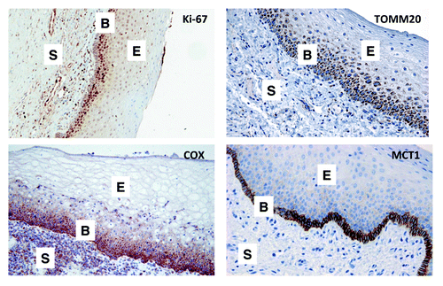 Figure 1. Distribution of proliferative and mitochondrial biomarkers in normal mucosa. Normal mucosal tissue was subjected to staining (brown color) with a variety of metabolic markers. Note that the basal “stem cell” layer is highly enriched in markers of proliferation (Ki-67), oxidative mitochondrial metabolism (TOMM20 and COX) and L-lactate/ketone body utilization (MCT1). Based on these studies, MCT1 is a highly selective marker of the basal stem cell layer. S, underlying connective tissue layer; B, basal stem cell layer; E, differentiating squamous epithelial layer. Original magnification: 20× (Ki-67 and COX); 40x (TOMM20 and MCT1).