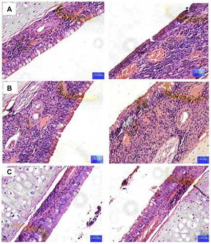 Figure 6 Histopathological studies of corneal tissue of different groups. (A) normal; (B) TAC SLNs (C) TAC SLNs-ISG. Left: treatment eye; Right: un-treatment eye.