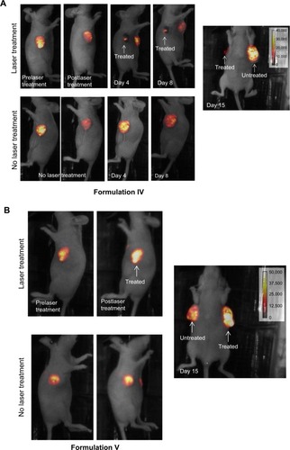 Figure 7 Effect of laser treatments on luciferase expression and tumor regression in mice injected with liposomes.Notes: (A) Luciferase expression in mice injected with Formulation IV at various time periods. (B) Luciferase expression in mice injected with Formulation V at various time periods.